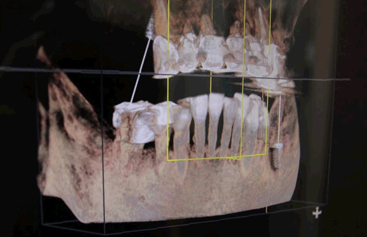 治療の為に正確な診断が重要